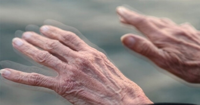 İstirahat halinde görülen el titremesi Parkinson habercisi olabilir!