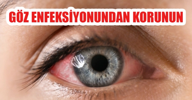 Konjonktivit Nedir?