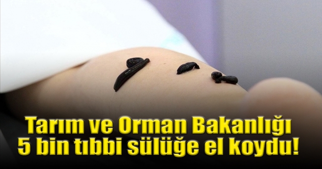 Valizde kilolarca tıbbi sülük bulundu